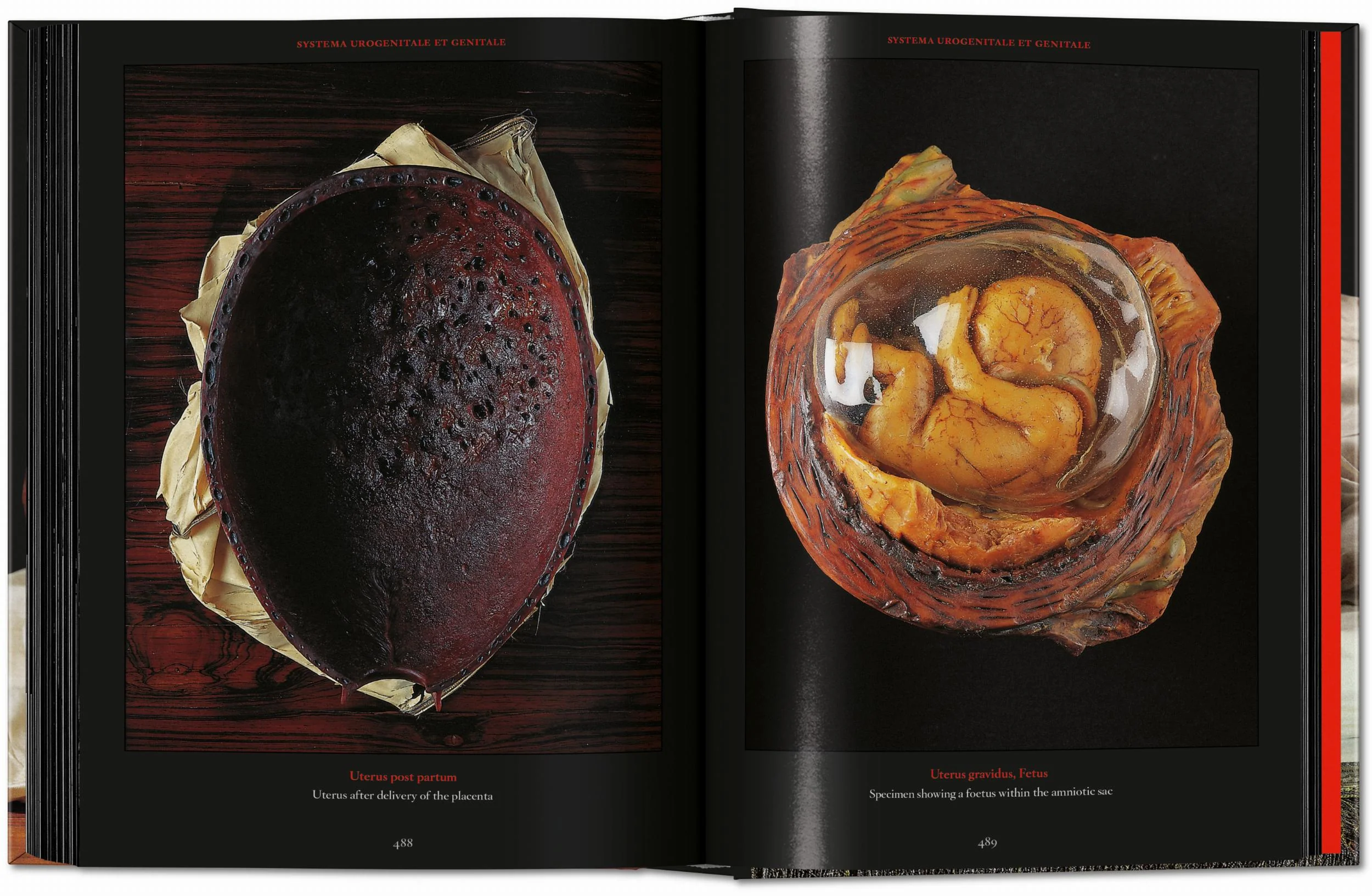 Anatomical Waxes. 45th Ed. (German, French, English) - Image 26