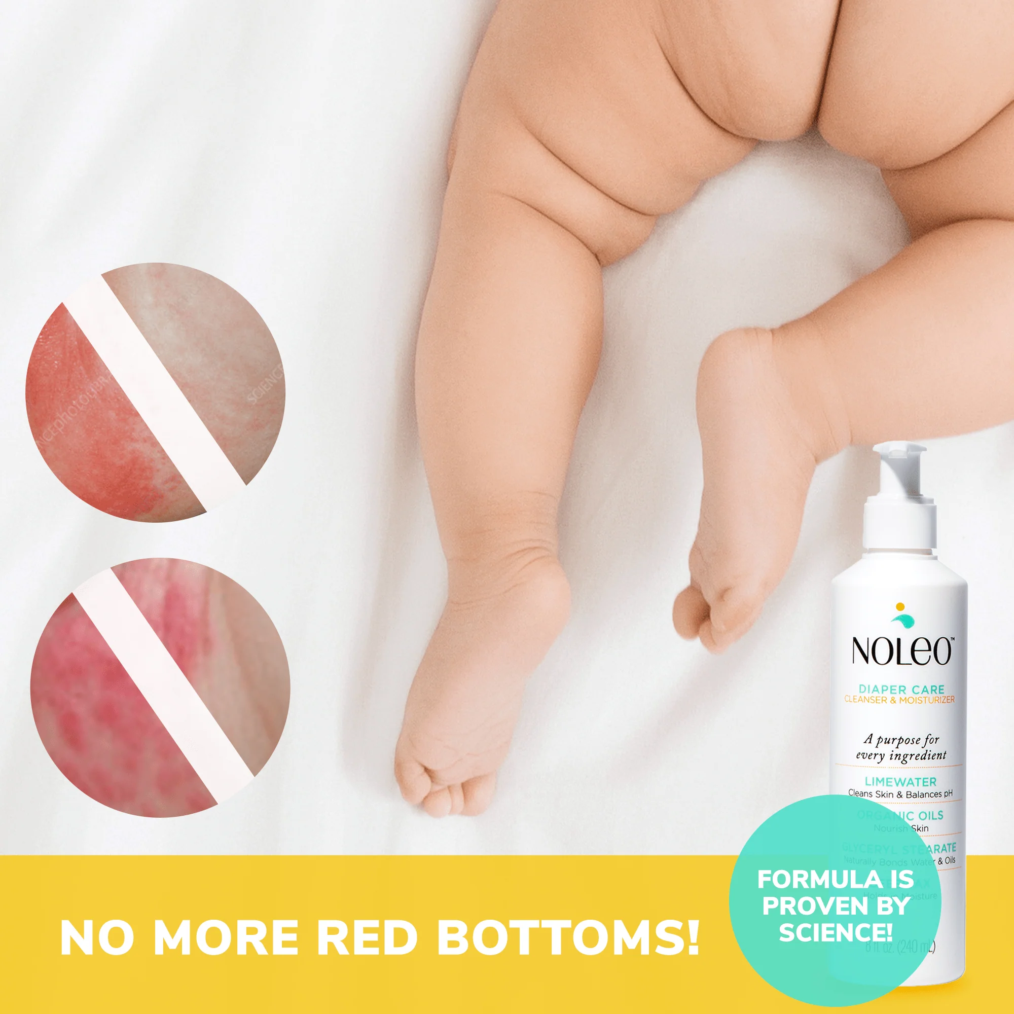 NOLEO DUO: 3-in-1 Diaper Rash Cream & Large Cotton Pads - Image 6